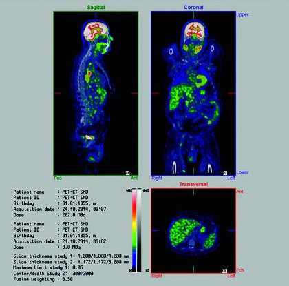 Automated Image Fusion1