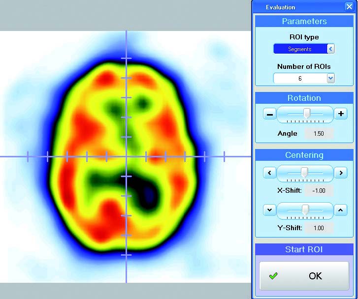 slice processing for allocation into right and left (rotation / shift)