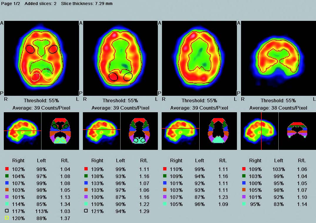 for further comparisons additional ROIs can be defined for each layer