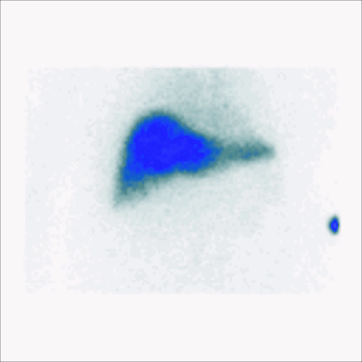 hepatobiliary-animated