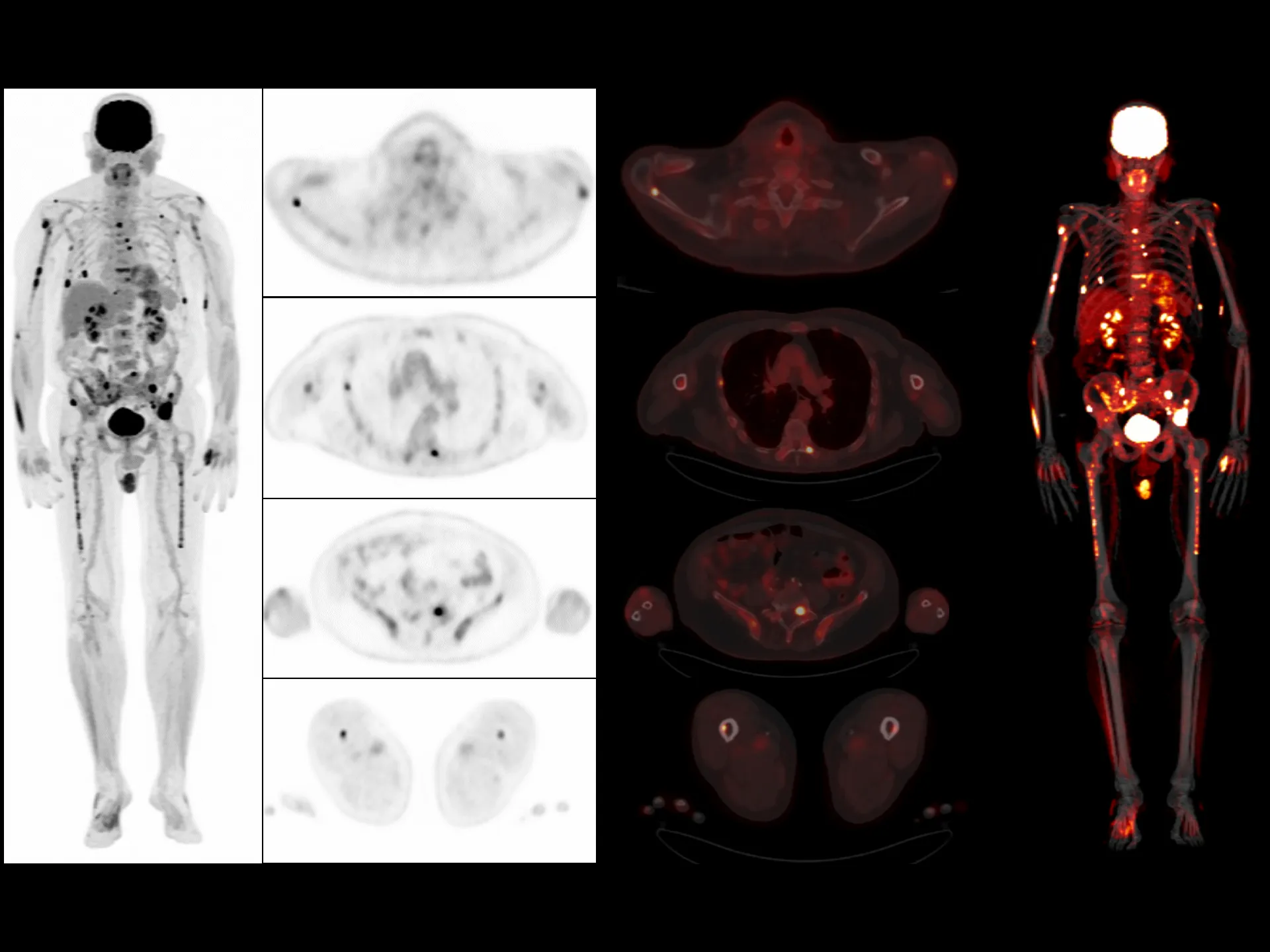 10-min Total-body Imaging with Low Dose