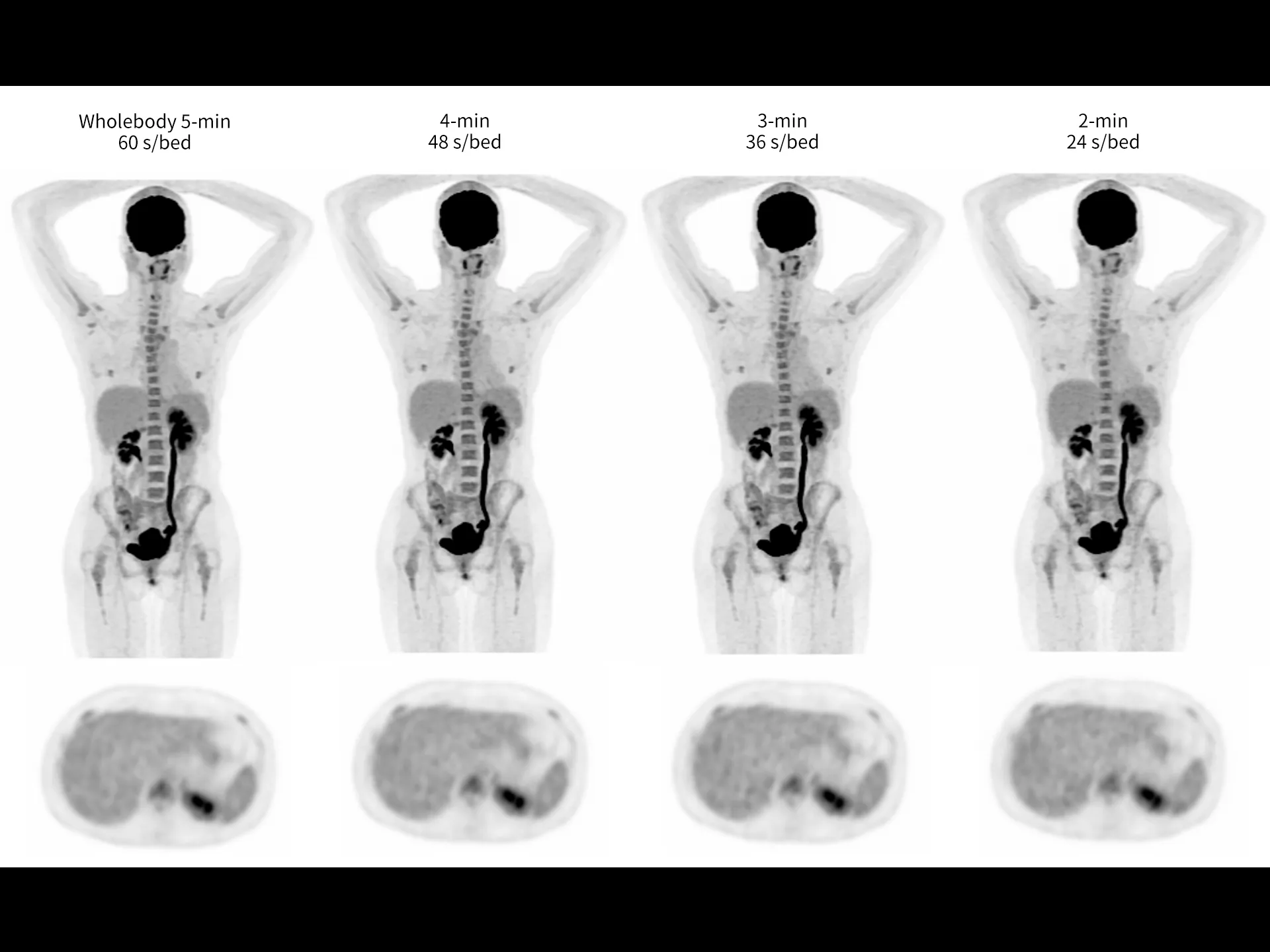 Fast Whole-body Imaging Down to 2-min