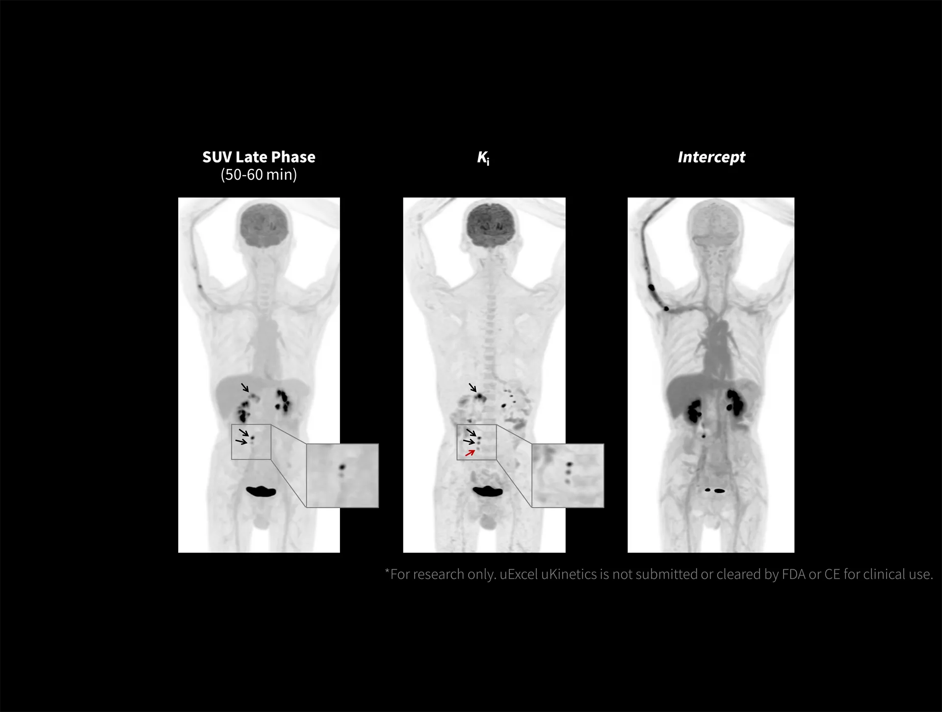 Ki imaging demonstrates enhanced contrast in pancreatic lesions and increased detection of metastases.
