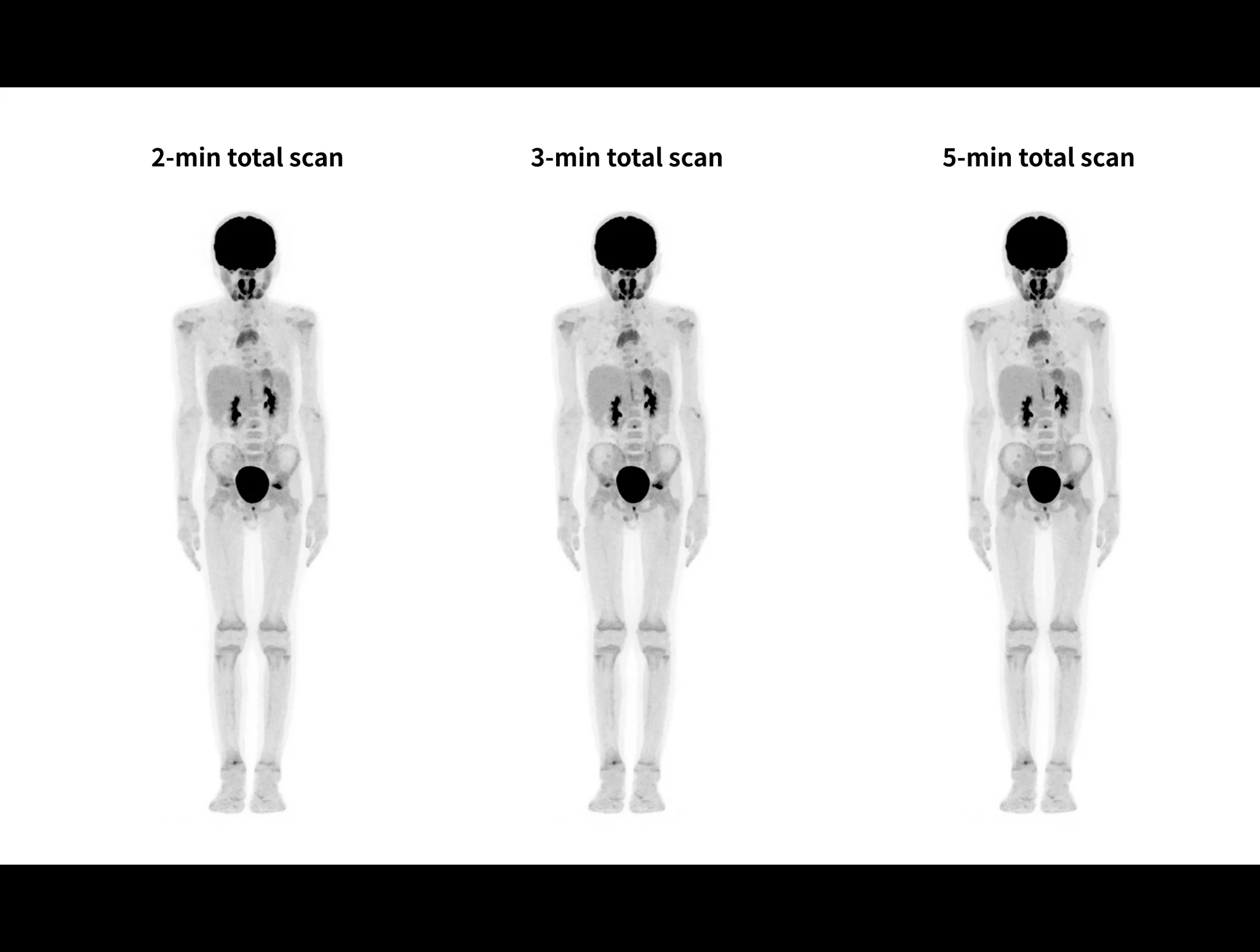 With uExcel DPR, uMI Panorama enables Pediatrics fast scanning without compromising image quality.