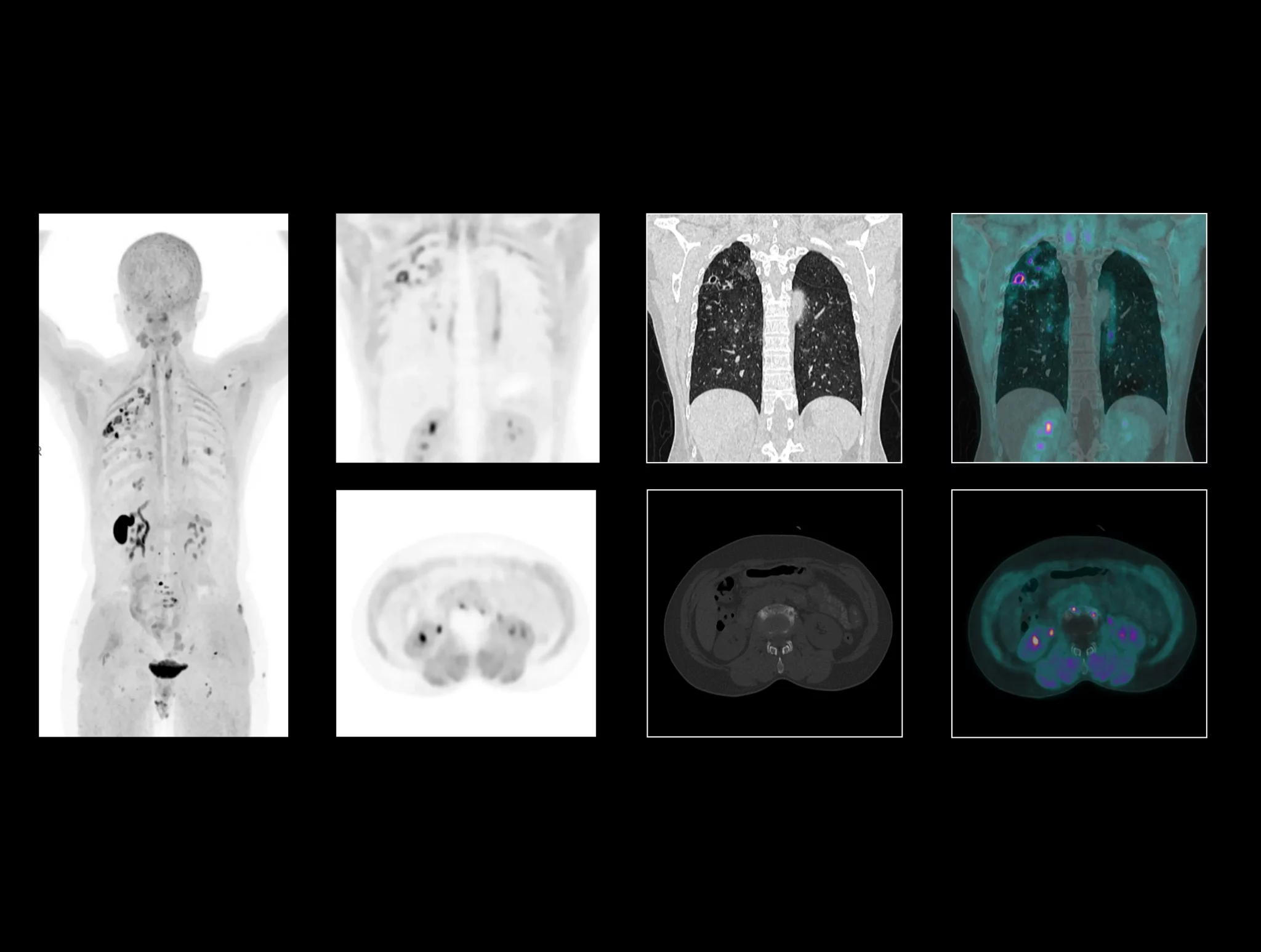 uMI Panorama facilitates a systematic assessment of marneffei basket bacteria infection.