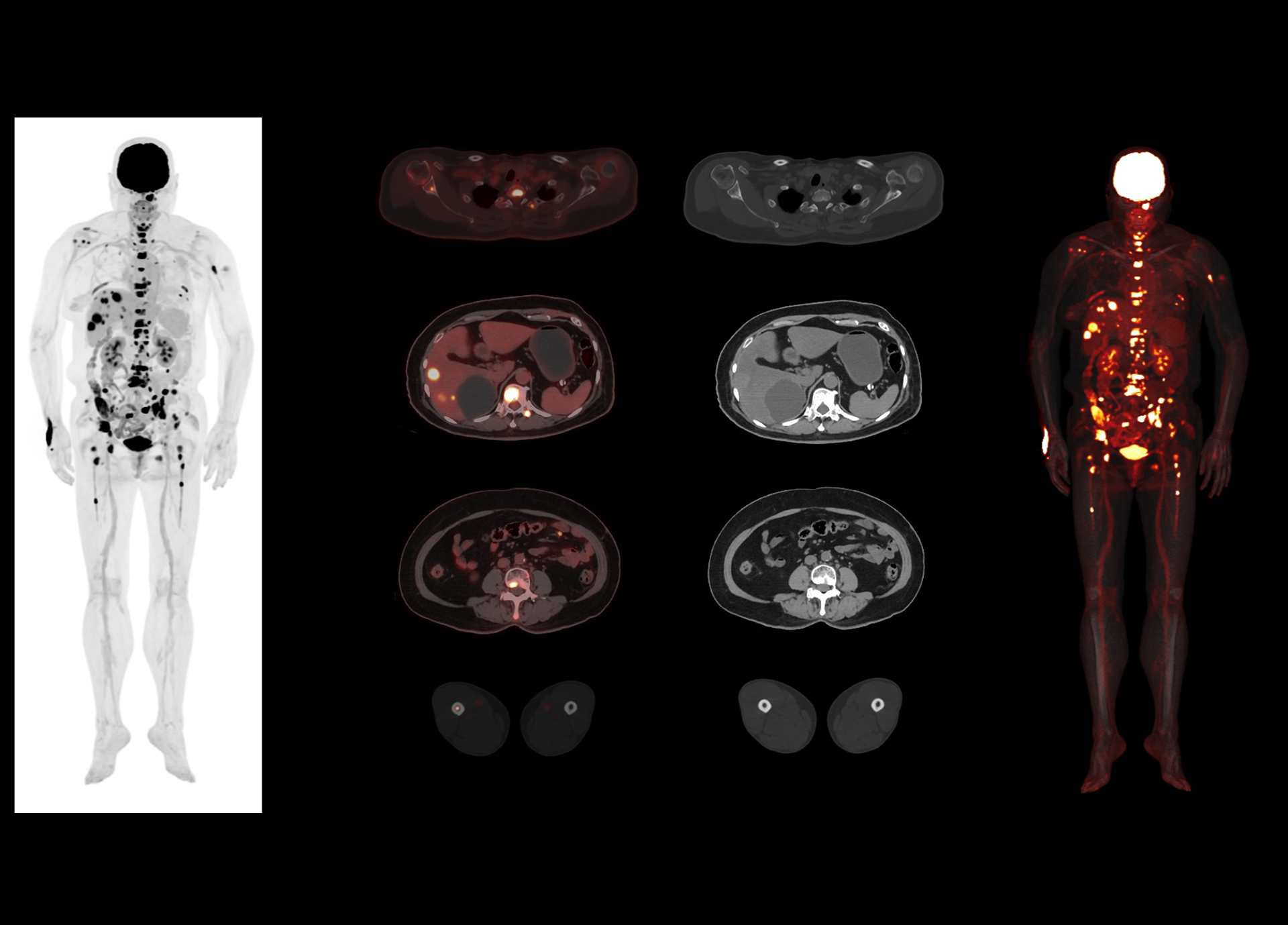 Clear Delineation of Lesions from Vertex to Toe in 4 min