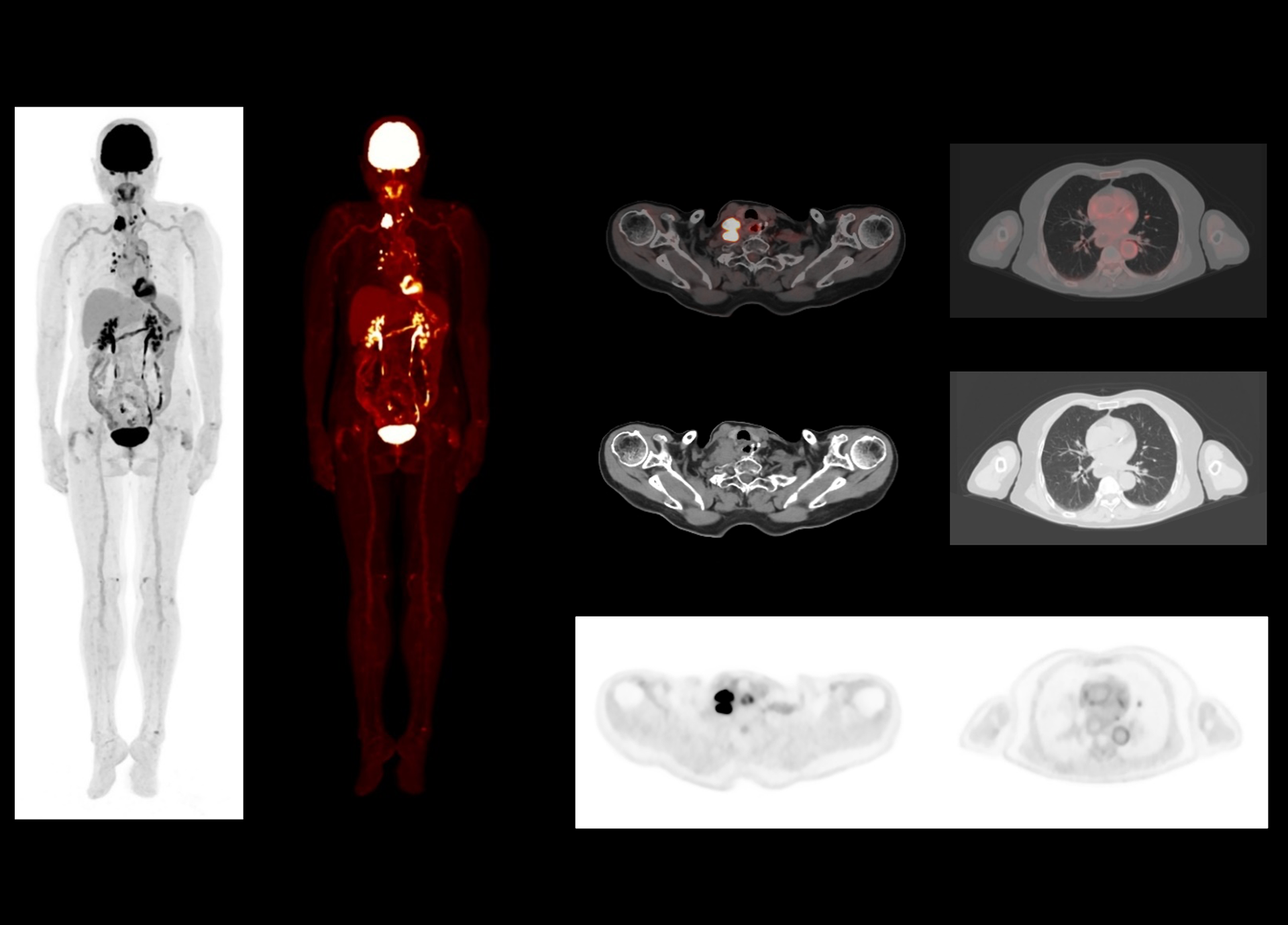 3 min fast scan with low dose usage