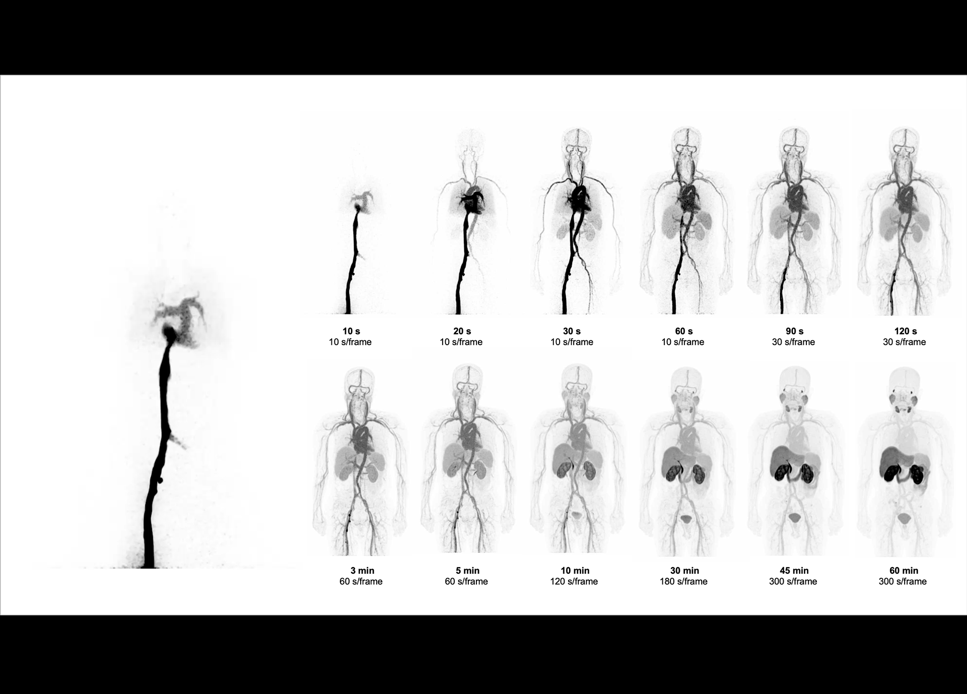 Whole-body Dynamic Imaging