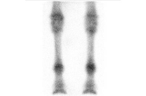Dorsal Flow Image of Distal Forelimbs - scintigraphy
