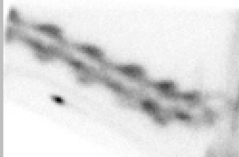 Lateral Bone Phase Cervical Region - scintigraphy