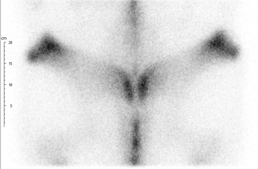 Screenshot Becken oben - crop